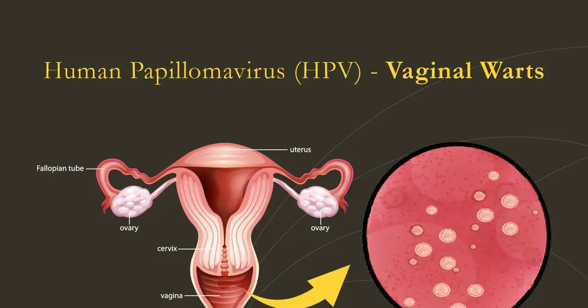 hpv — IN news