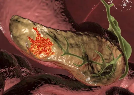 cancer patient — IN news